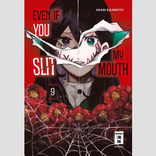 Even if you slit my Mouth Bd. 9